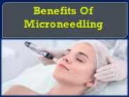 Benefits Of Microneedling