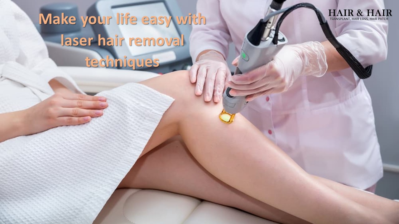 Make your life easy with laser hair removal techniques