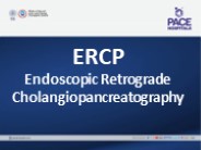 ERCP Procedure - Endoscopic Retrograde Cholangiopancreatography