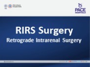 RIRS Surgery - Procedure & Benefits