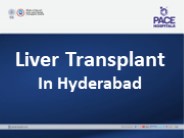 Liver Transplant in Hyderabad
