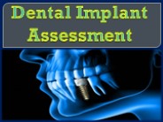 Dental Implant Assessment