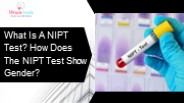 What Is A Nipt Test? How Does The Nipt Test Show Gender?