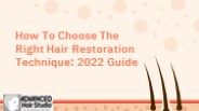 How To Choose The Right Hair Restoration Technique