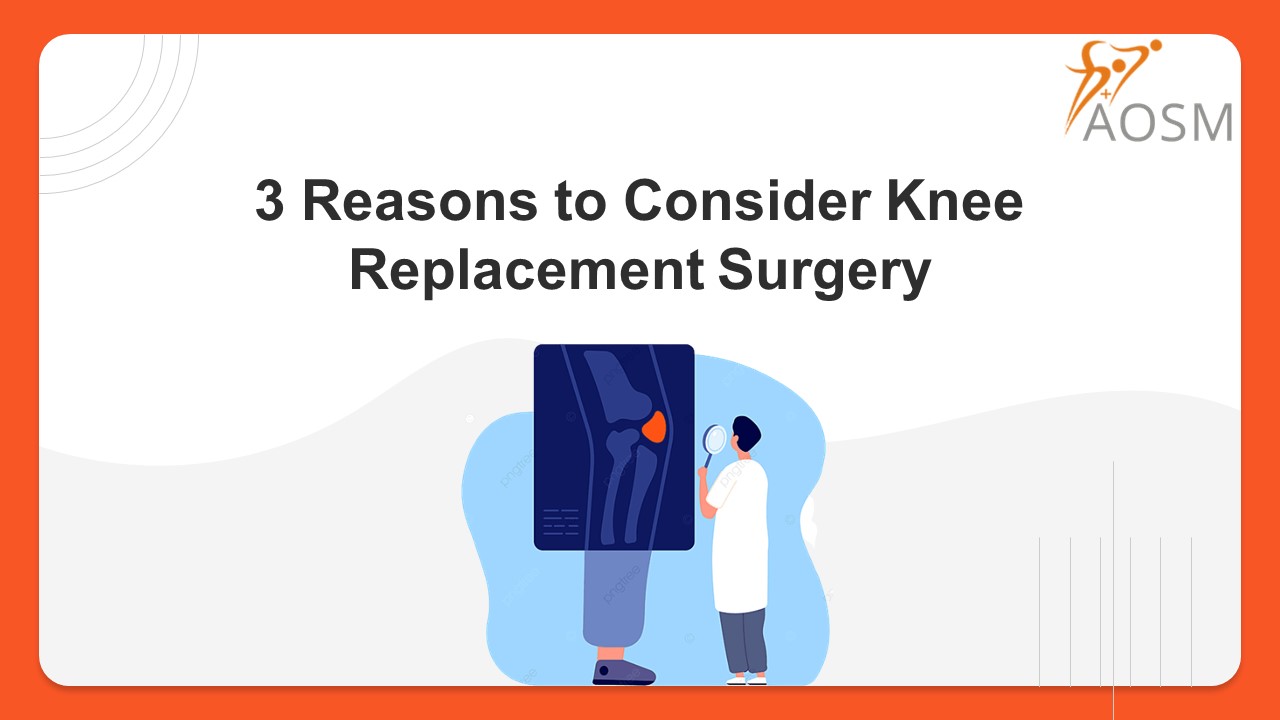 PPT 3 Reasons to Consider Knee Replacement Surgery PowerPoint