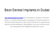 Best Dental Implants Dubai