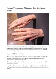 Varicose veins latest Treatment