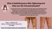 Radiofrequency Skin Tightening | Luxe Body Sculpts