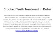 Crooked Teeth Treatment in Dubai