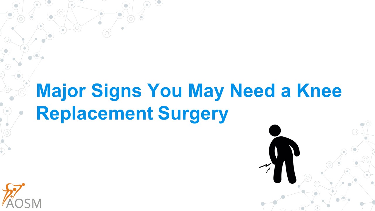 PPT Major Signs You May Need a Knee Replacement Surgery PowerPoint