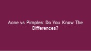Acne vs Pimples: Do You Know The Differences?