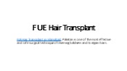 best fue hair transplant in Islamabad