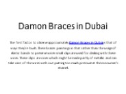 Damon Braces Dubai