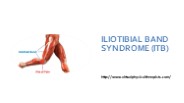 ILIOTIBIAL BAND SYNDROME (ITB)
