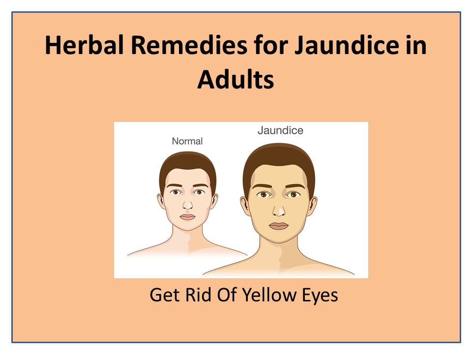 PPT Jaundinil Capsule to Get Rid Of Jaundice (1) PowerPoint