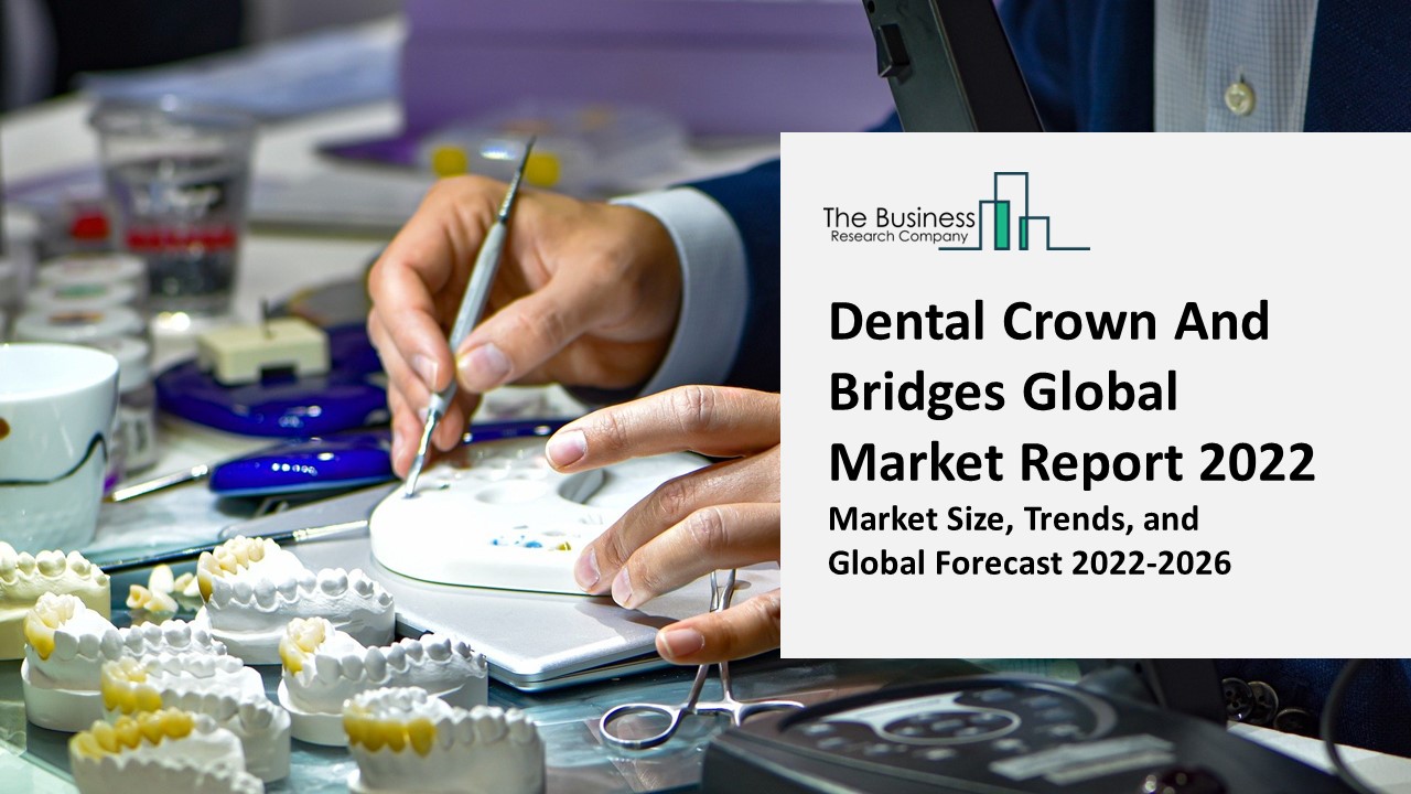 Dental Crown And Bridges Market Report Overview, Top Industry Players ...