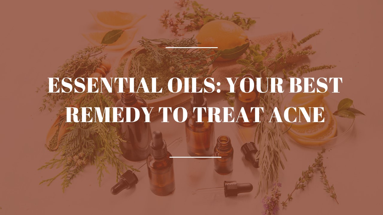 Essential Oils Is Your Best Remedy to Treat Acne