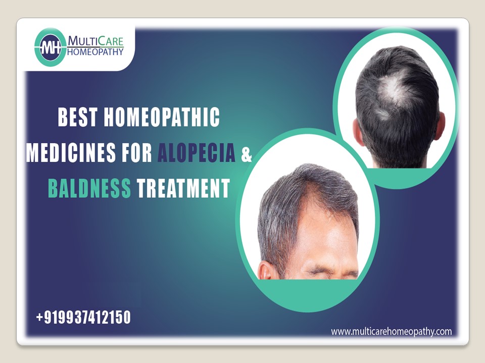 PPT Best Homeopathic Medicine for ALOPECIA & BALDNESS Treatment at