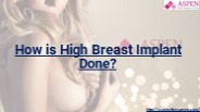 How is High Breast Implant Done?