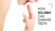 How Bulimia Can Damage Teeth