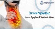 Cervical Myelopathy: Causes, Symptoms & Treatment Options