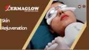 Skin Rejuvenation | Dermaglow Skin Clinic