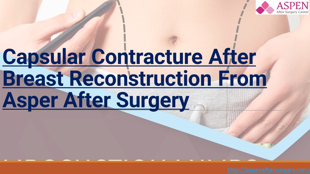 Capsular Contracture After Breast Reconstruction From Aspen After Surgery