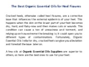 The Best Organic Essential Oils for Heel Fissures