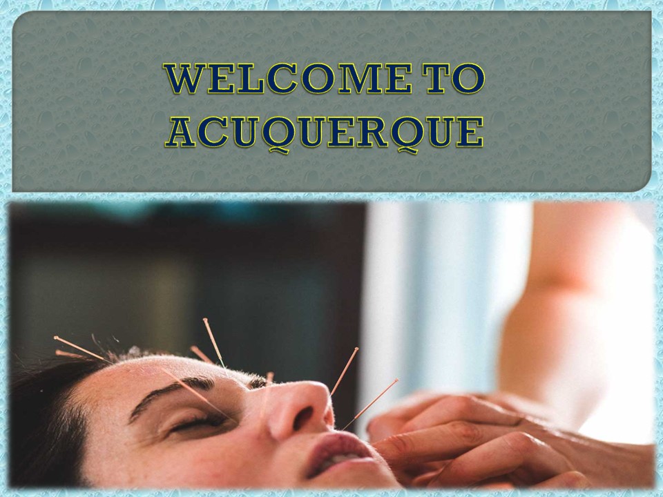 WELCOME TO ACUQUERQUE