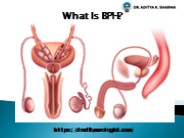 Urology Doctor for BPH Treatment