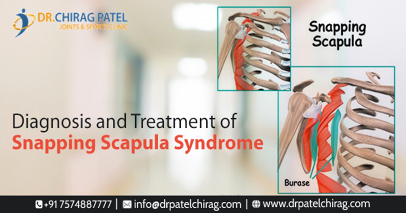 PPT Is Snapping Scapula Syndrome Dangerous PowerPoint presentation
