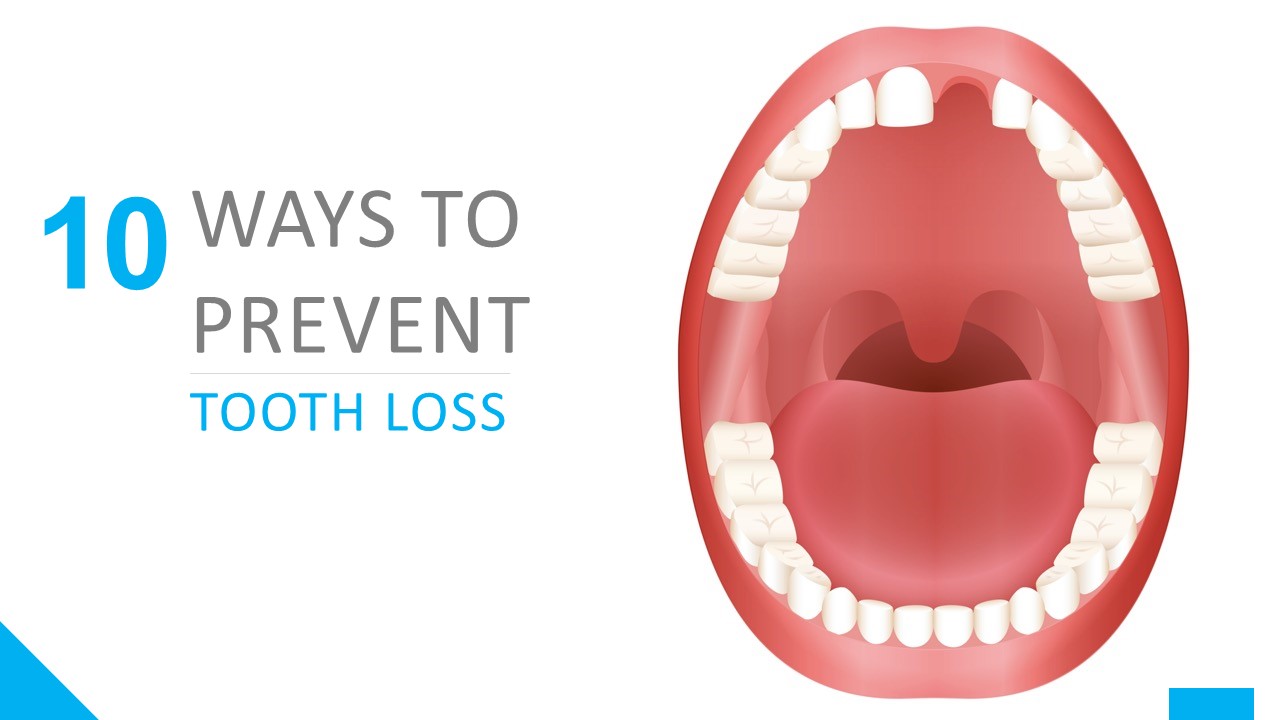 PPT 10 Ways to Prevent Tooth Loss PowerPoint presentation free to