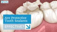 Are Protective Tooth Sealants Effective