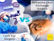 Lasik vs Refractive Lens Exchange Surgery