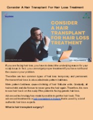 Consider A Hair Transplant For Hair Loss Treatment