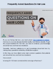 Frequently Asked Questions On Hair Loss