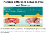 The main difference between cracks and heaps (1)