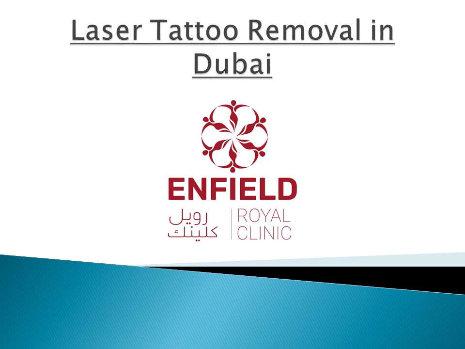 Laser Tattoo Removal Cost in Dubai