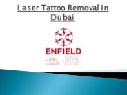 Laser Tattoo Removal Cost in Dubai