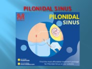 Pilonidal Sinus