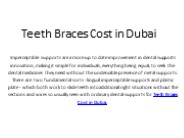 Teeth Braces Cost in Dubai
