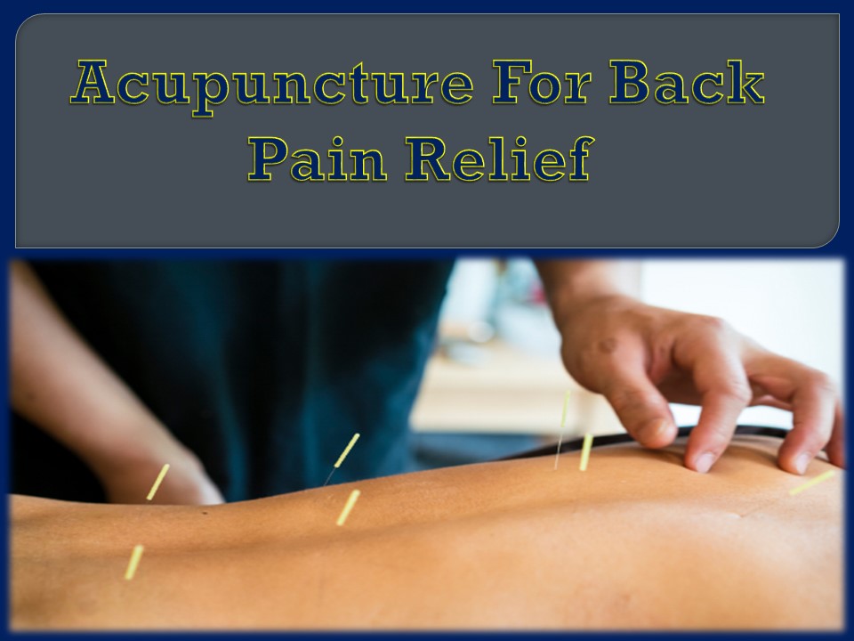 Acupuncture For Back Pain Relief