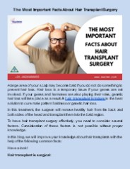The Most Important Facts About Hair Transplant Surgery
