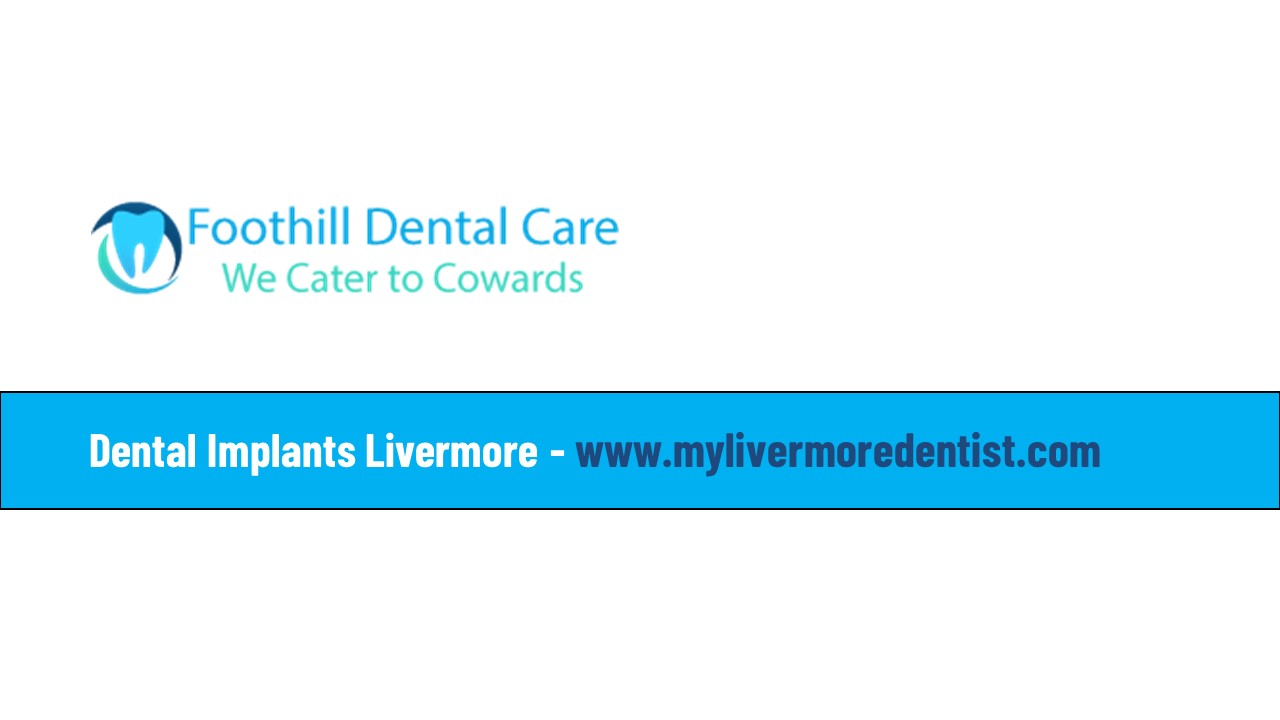 PPT Dental Implants Livermore PowerPoint