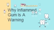 Gum Treatment In Dubai