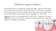 types of braces