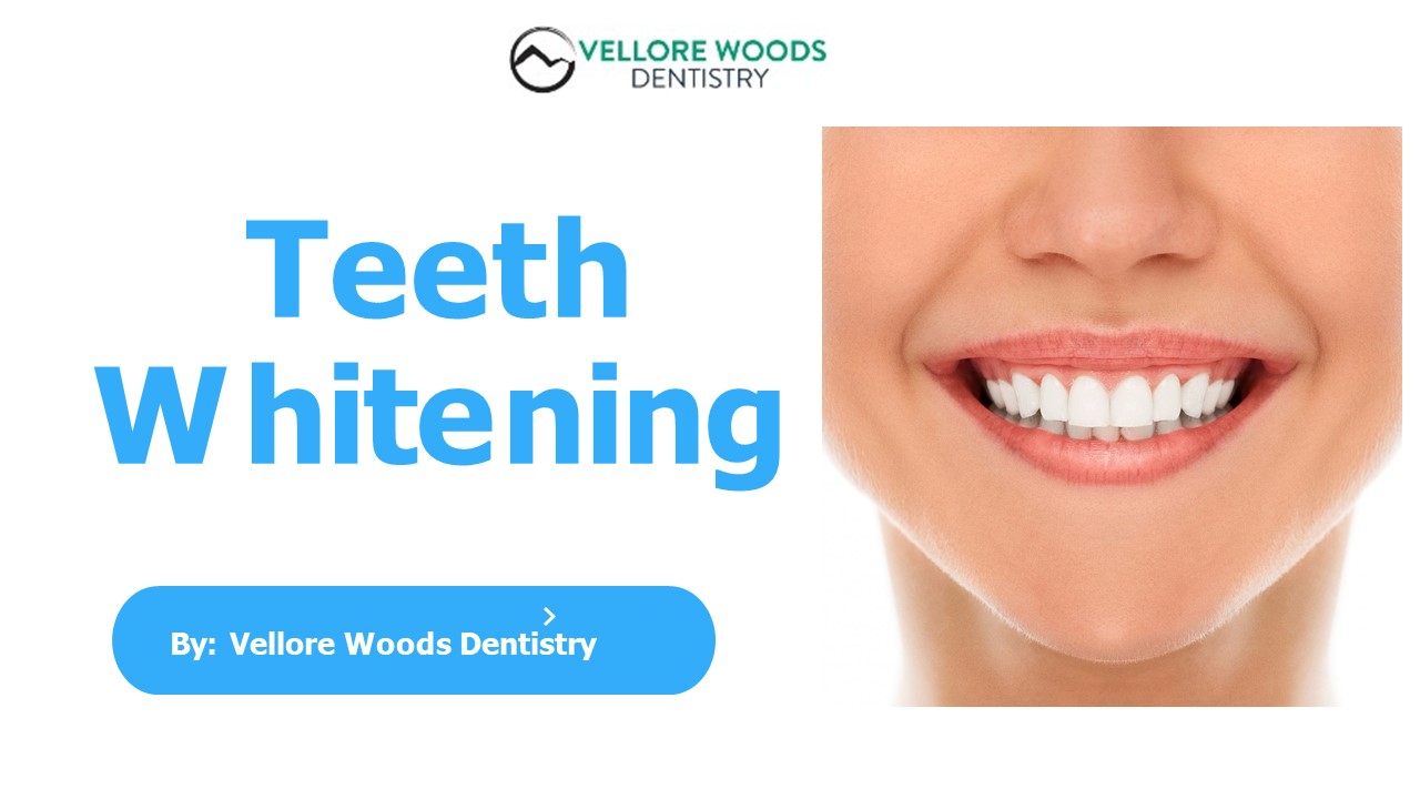 All You Need to Know About Teeth Whitening (1)