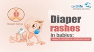 Diaper Rashes In Babies: Reasons, Symptoms and Treatments