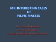 Pelvic Tumors