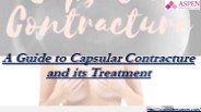 A Guide to Capsular Contracture and its Treatment